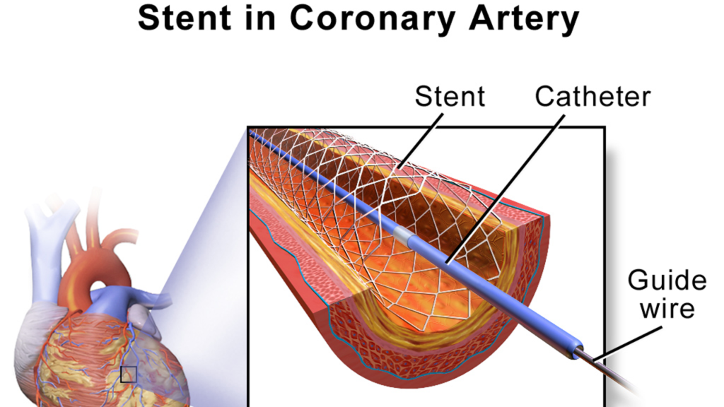 njiocardiac