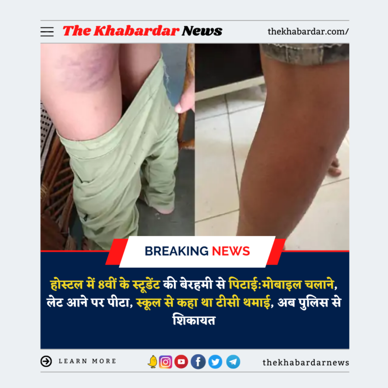 होस्टल में 8वीं के स्टूडेंट की बेरहमी से पिटाई:मोबाइल चलाने, लेट आने पर पीटा, स्कूल से कहा था टीसी थमाई, अब पुलिस से शिकायत